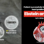 Patient successfully treated for a rare heart problem called Ebstein anomaly by Dr. Abhay Jain