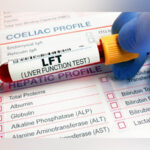 When Should You Get Liver Function Tests Done? Signs and Symptoms that Warrant Testing When Should You Get Liver Function Tests Done? Signs and Symptoms that Warrant Testing