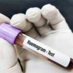 Why is a Hemogram Test Prescribed? Why is a Hemogram Test Prescribed?