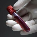 Which Blood Test Can Help Detect Infections? Which Blood Test Can Help Detect Infections?